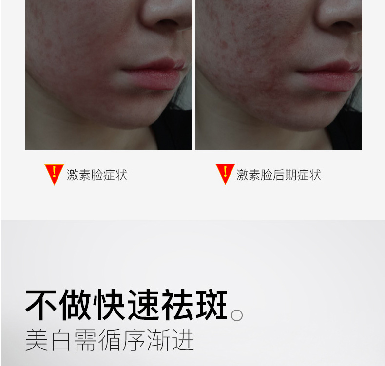 广州美白面霜代加工-美白祛斑霜淡化色斑保湿面霜oem/odm代加工厂家