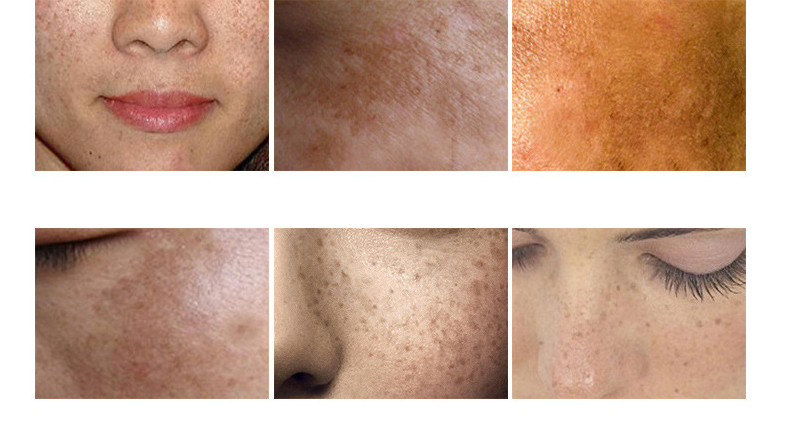 美白祛斑修护霜OEM/ODM代加工厂，广州美白淡斑半成品贴牌代加工