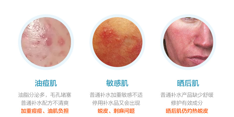 舒敏修护精华液代加工-提亮肤色补水保湿淡化红血丝修护肌肤