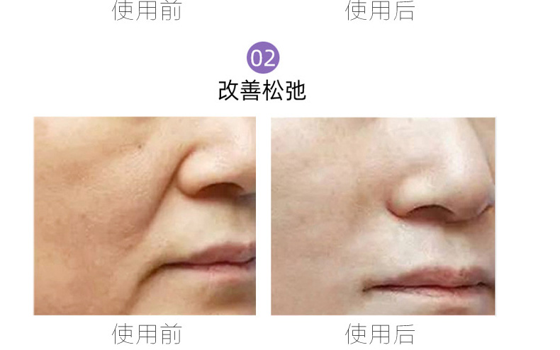 玻色因面部精华代加工厂家-多肽精华紧致修护改善肌肤提亮肤色改善暗沉